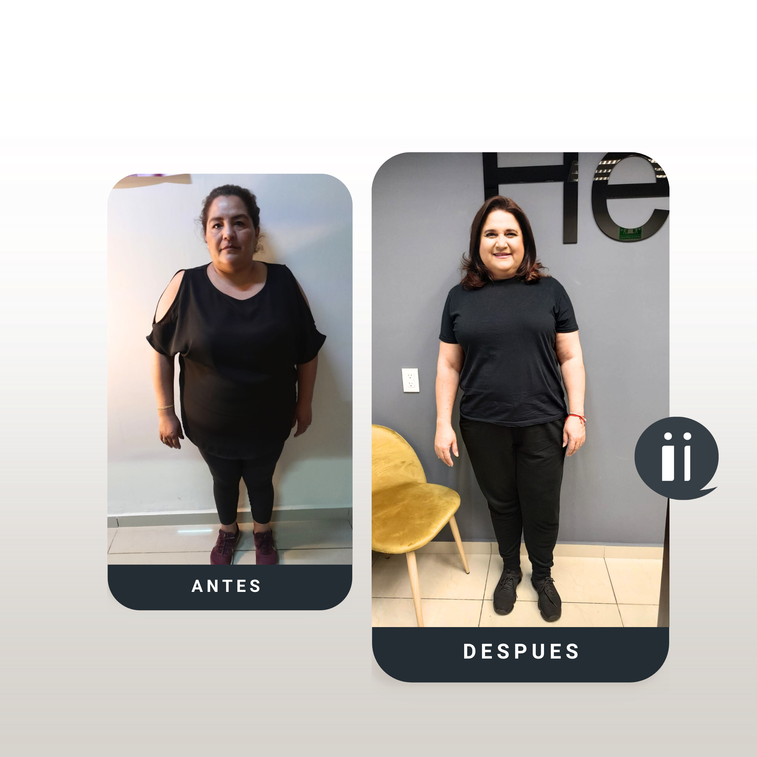 Antes / Después 4