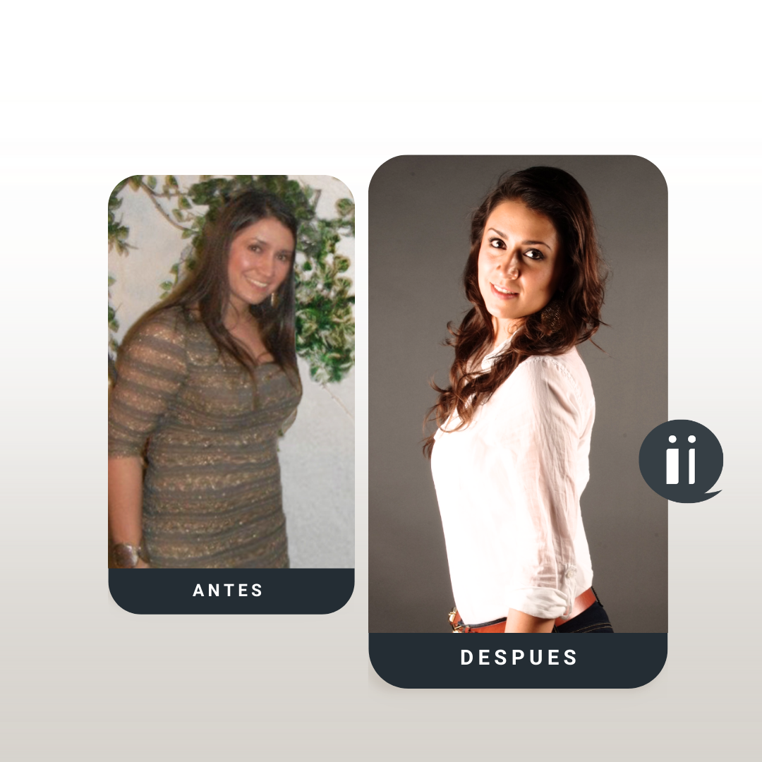 Antes / Después 13