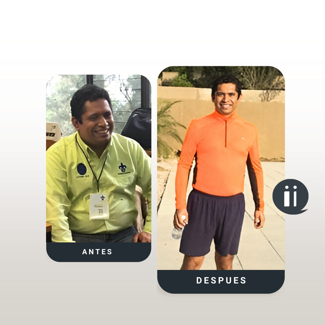 Antes / Después 14