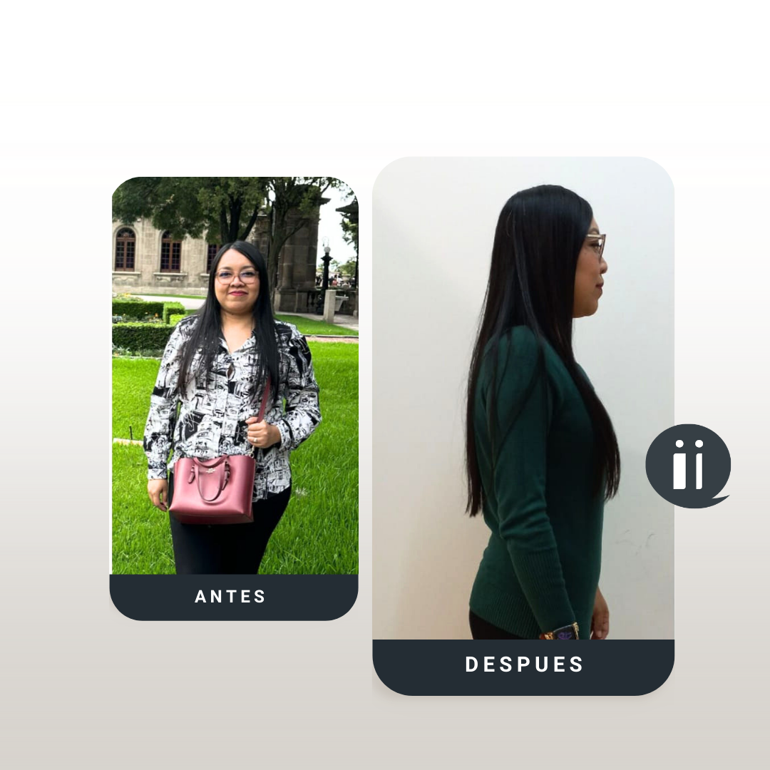 Antes / Después 16