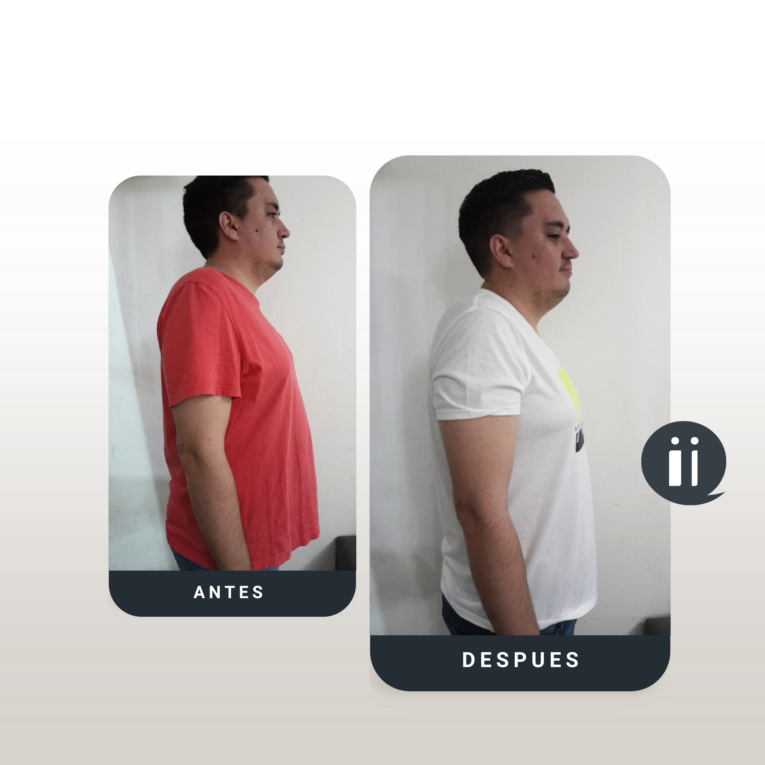 Antes / Después 7